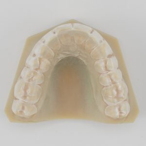 Clear Splint™
