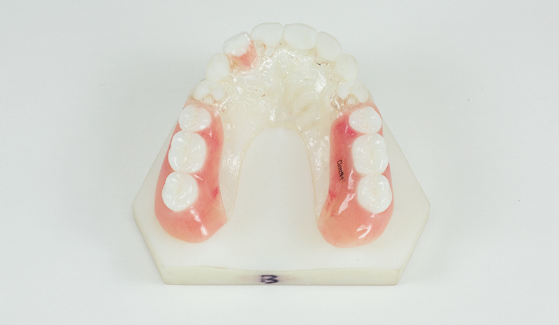 ClearMet Partials