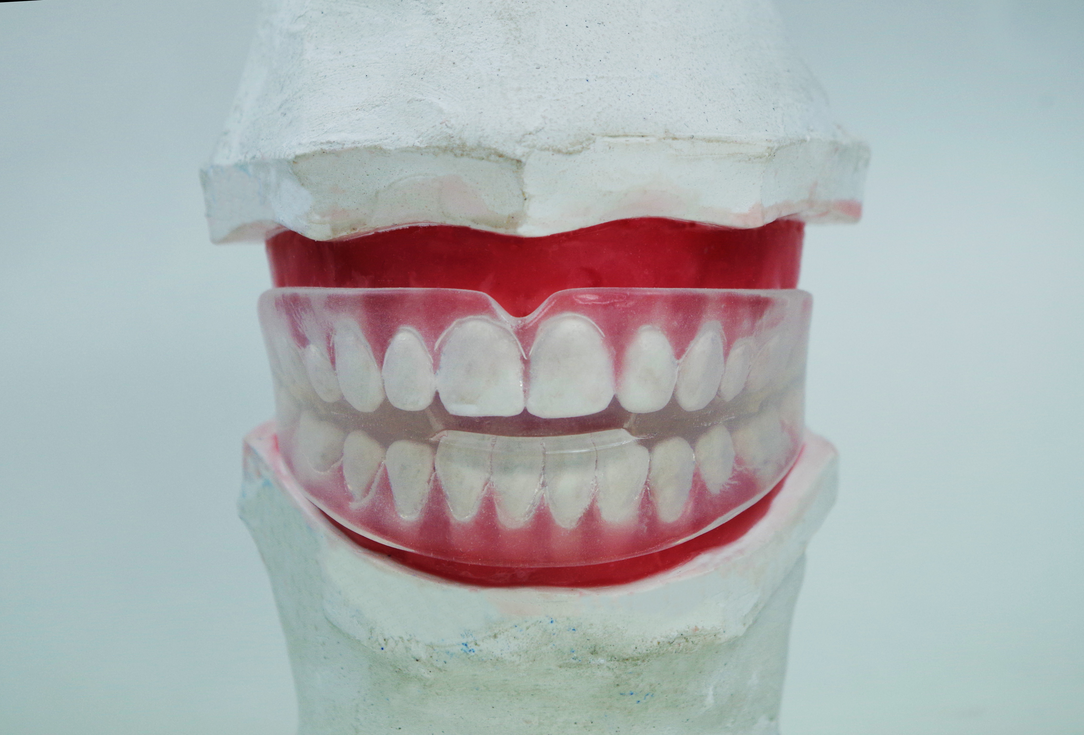 Tooth Positioner
